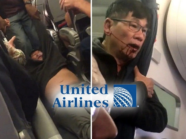  ბორტიდან გაძევებული მგზავრი, United Airlines-ის წინააღმდეგ სარჩელს ამზადებს (ვიდეო)