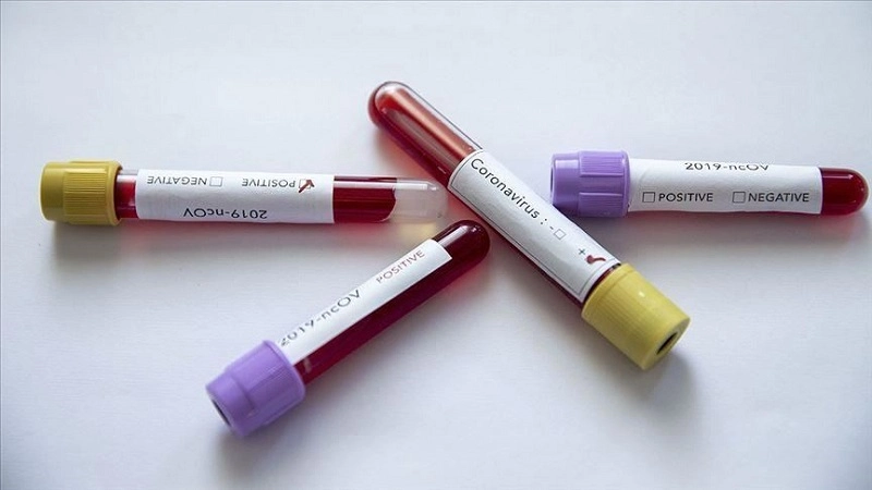 კორონავირუსის 3 ახალი შემთხვევა გამოვლინდა საფრანგეთში, ერთი დაინფიცირებული გარდაიცვალა